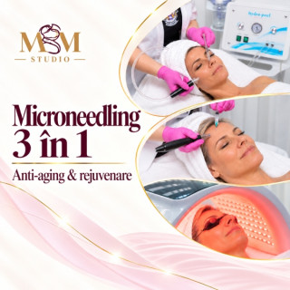 Microneedling 3 în 1 Anti-Aging – riduri, fermitate și regenerare