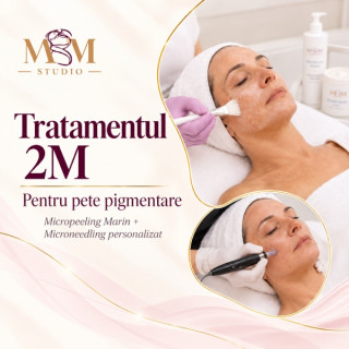 Tratamentul 2M pentru Pete Pigmentare – Micropeeling + Microneedling 