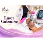 Laser Carbon Peel