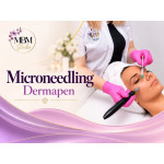 Microneedling (Dermapen)