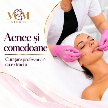 Tratament profesional pentru acnee și comedoane