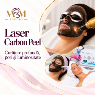 Carbon Peel Laser Ploiești – Hollywood Peel pentru pori, sebum și imperfecțiuni