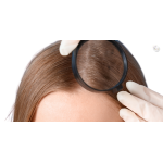 Tratamente tricologice pentru scalp