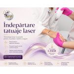 Îndepărtare tatuaje laser Ploiești