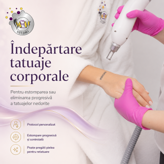 Îndepărtare tatuaj cu laser 
