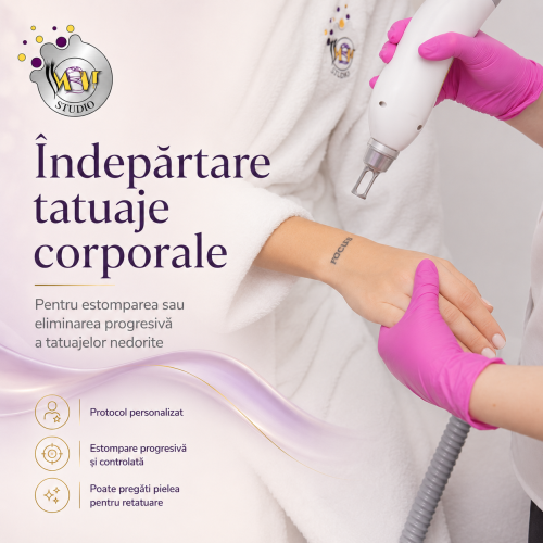 Îndepărtare tatuaje corporale cu laser ND:YAG Q-Switch la MBM Studio Ploiești
