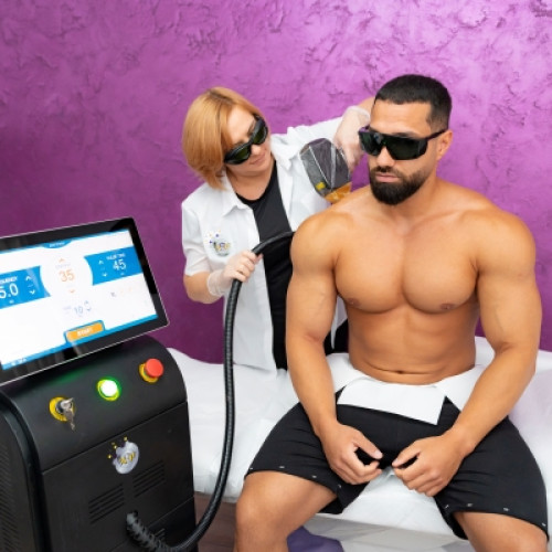 Epilare definitivă laser bărbați full body  - picioare și mâini total cu degete+axile+linia chilot (fără zona intimă)