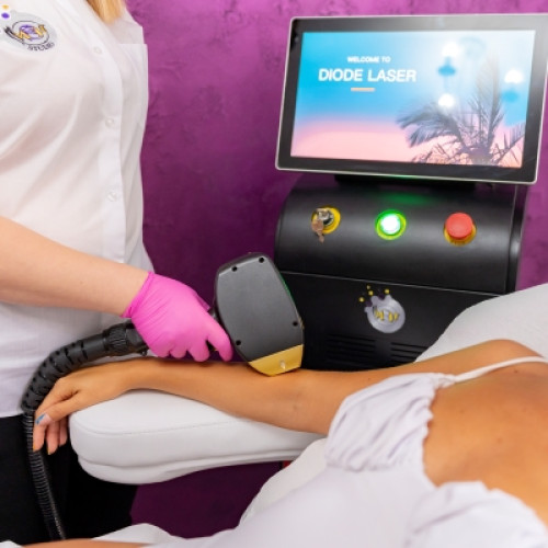 Epilare definitivă laser femei - zone mari