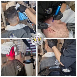 Tratament "Adio alopecie"