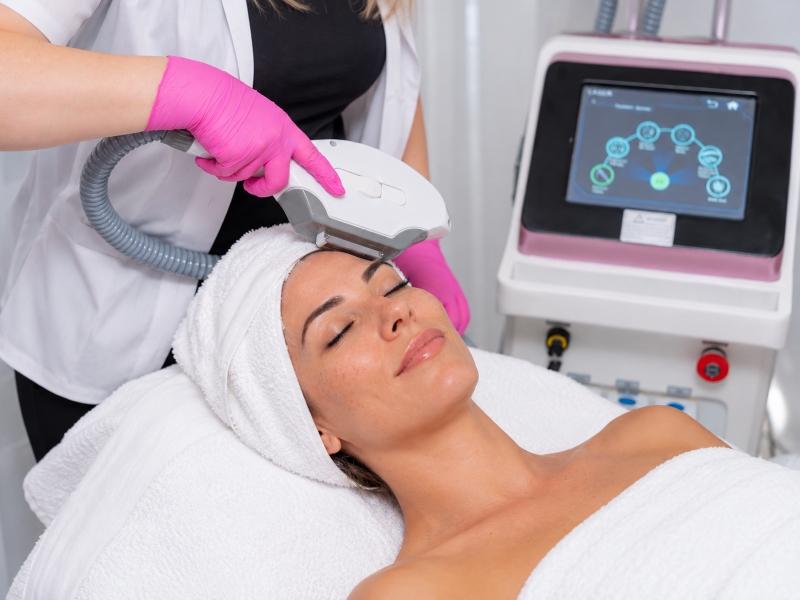 Tratament facial DPL IPL MBM Studio Ploiești