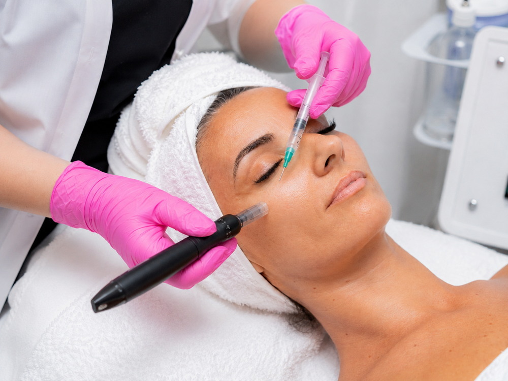 Tratament microneedling anti-aging Ploiești MBM STUDIO
