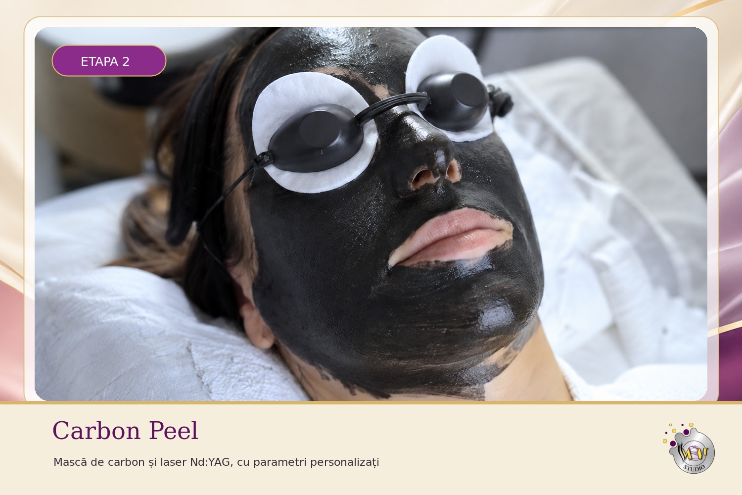 Aplicarea măștii de carbon în etapa Carbon Peel a tratamentului Total Beauty 4 în 1