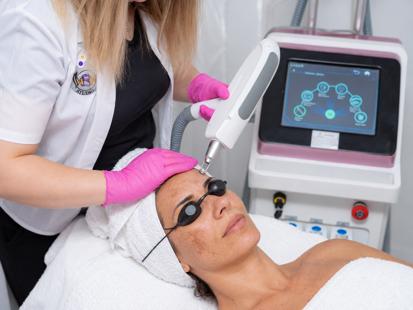 Tratament de rejuvenare facială cu laser Nd:YAG la MBM Studio Ploiești