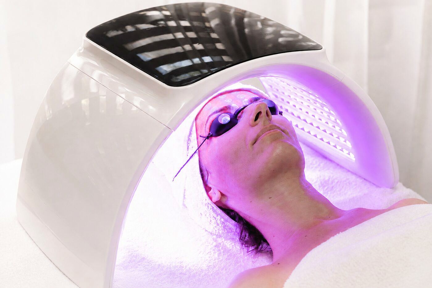 LED terapie după curățare cu extracții și microneedling
