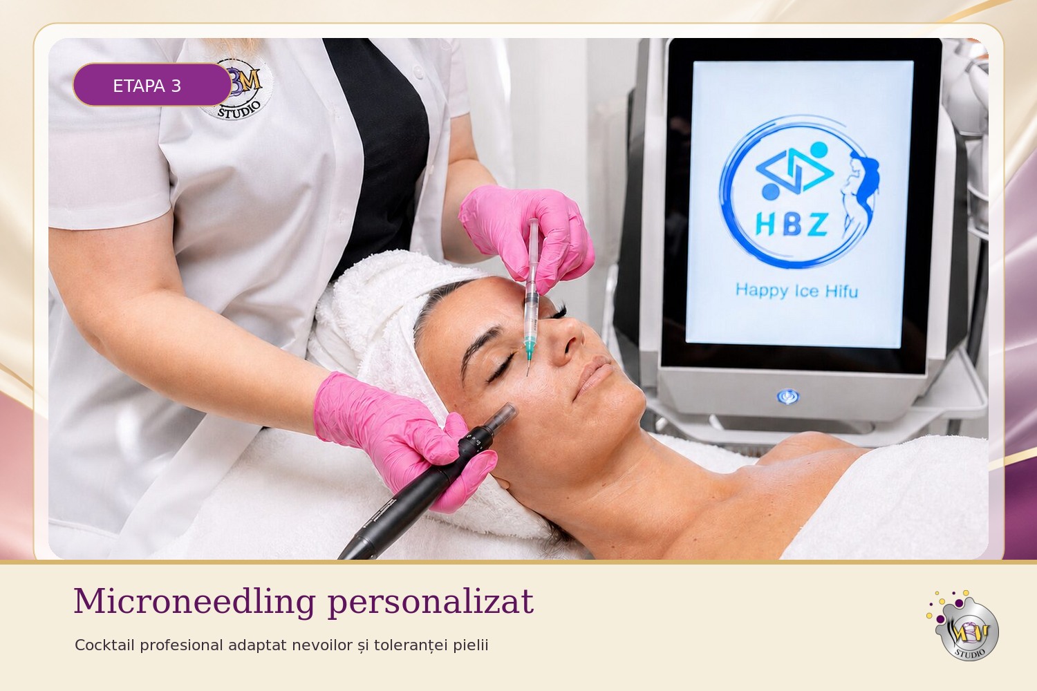 Microneedling personalizat pentru pori și urme post-acneice în Total Beauty 4 în 1